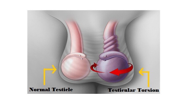 All About Testicles