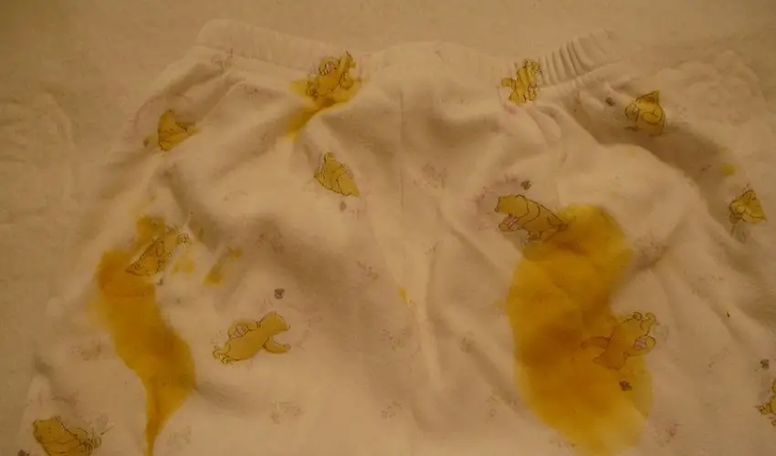 How To Get Poop Stains Out of Underwear